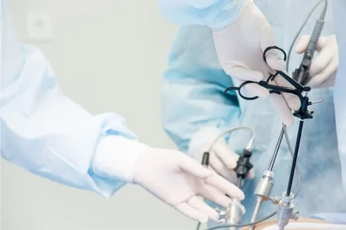 Laparoscopic Cholecystectomy: Everything You Need to Know | Gleneagles ...