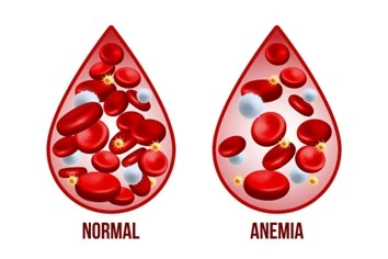Understanding anaemia with Gleneagles Hospital Kuala Lumpur