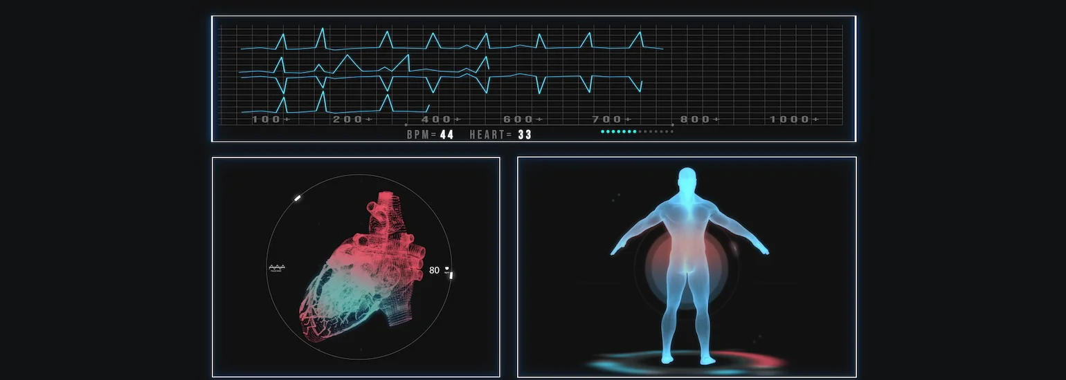 coronary-angiography-procedure