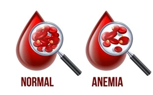 Understanding anaemia with Gleneagles Hospital Johor