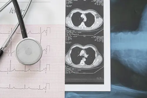 thoracic-surgery-ghj