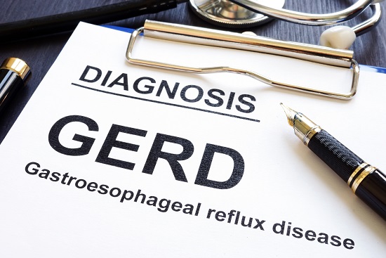 Gastroesophageal Reflux Disease (GERD)