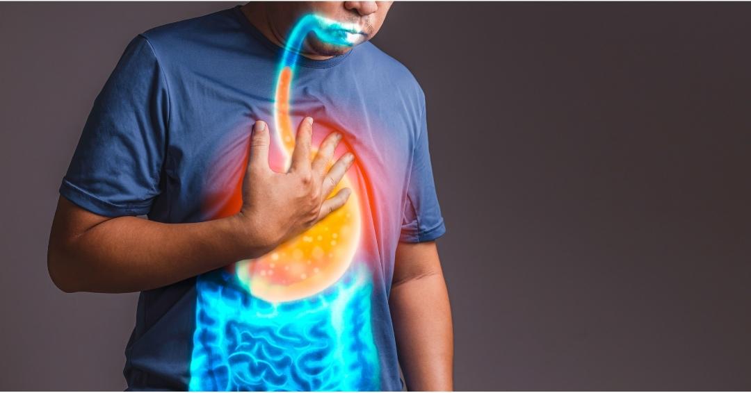 Diabesity and Gastroesophageal Reflux Disease (GERD): The Connection