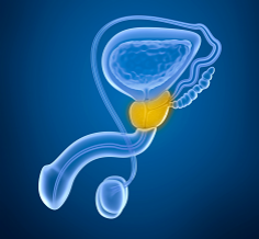 non-bacterial prostatitis