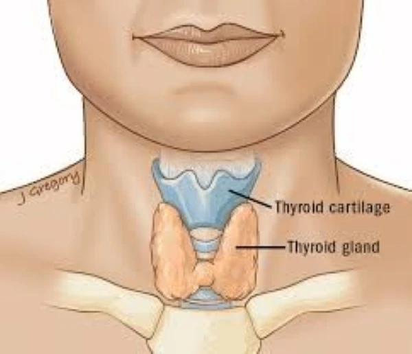 Scarless Thyroidectomy