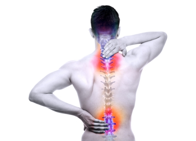 Spinal Stenosis: An Overview